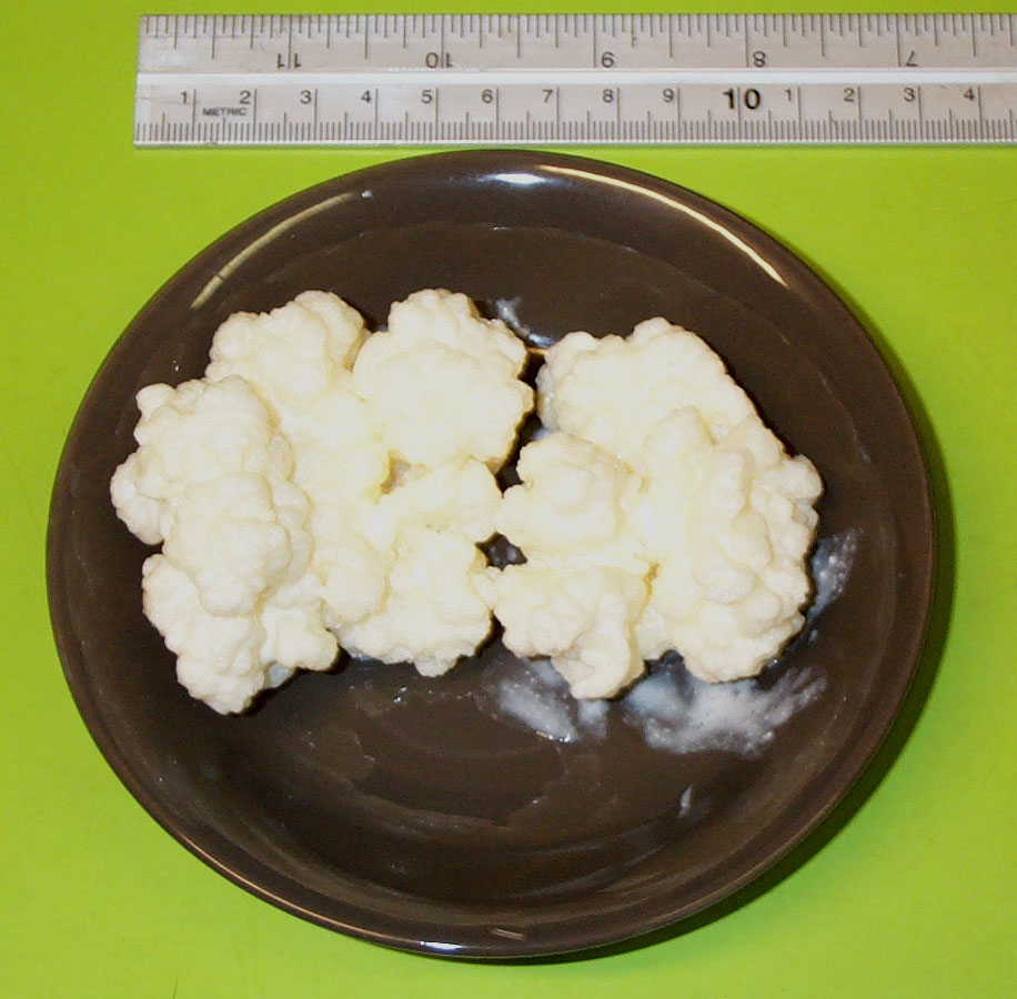 Kefir Contains More Probiotic Power Than Regular Yogurt (image credits: wikimedia)