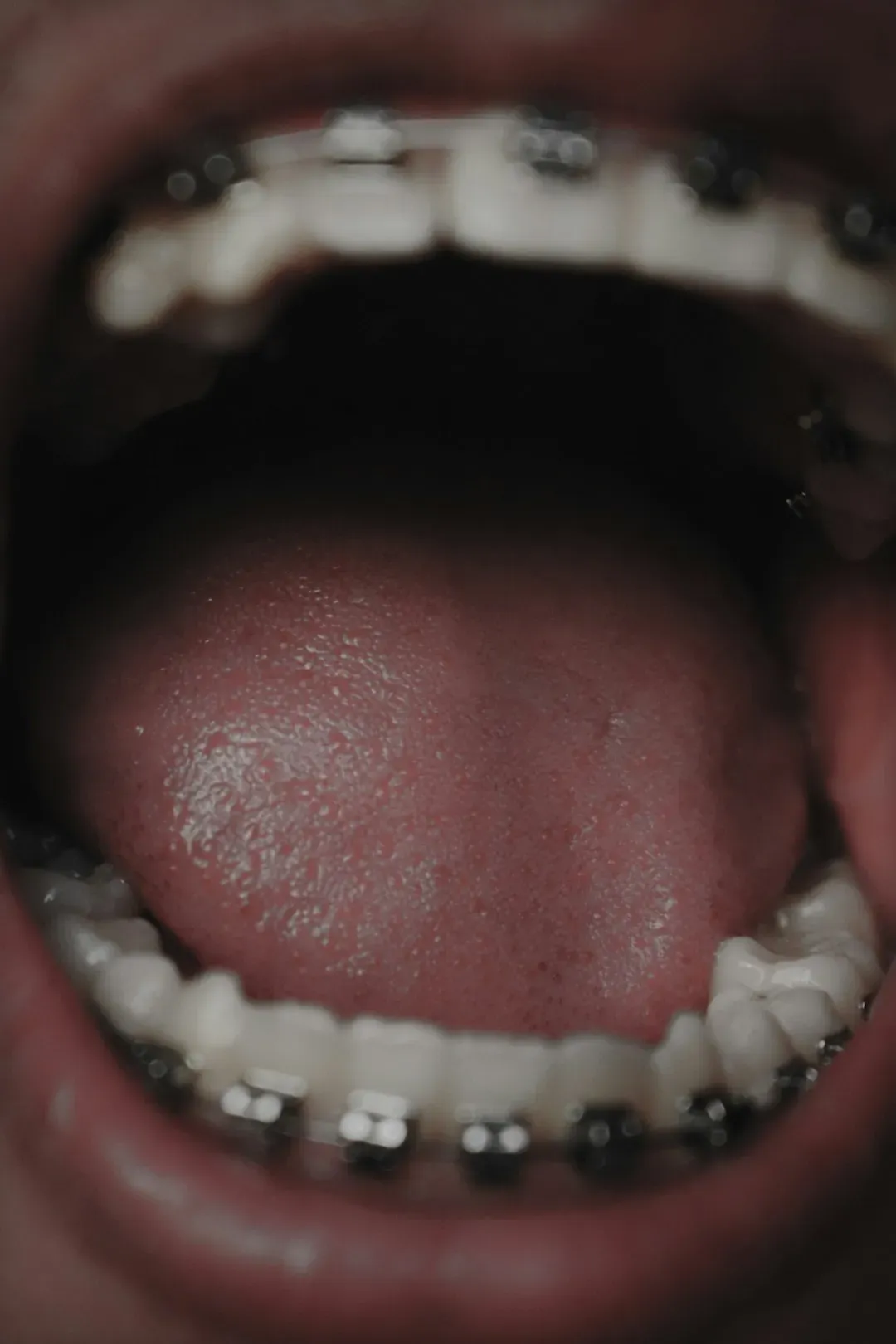 Sign #6: A Sore, Swollen, or Unusually Smooth Tongue (Image Credits: Unsplash)