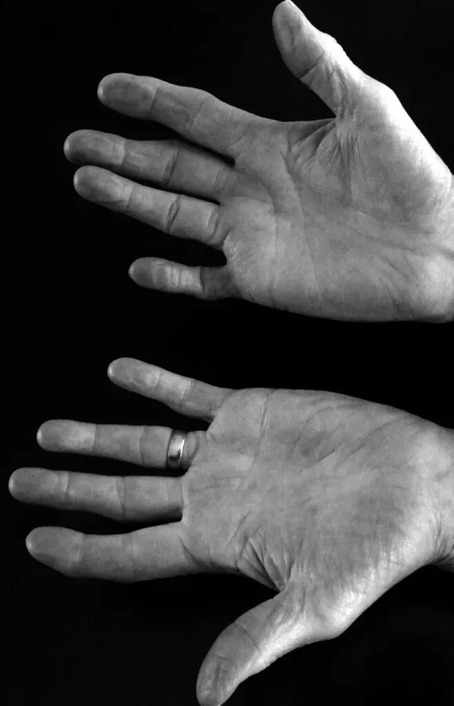 7. You've Been Feeling Numb or Tingling in Your Extremities (spratmackrel, Flickr, CC BY-SA 2.0)