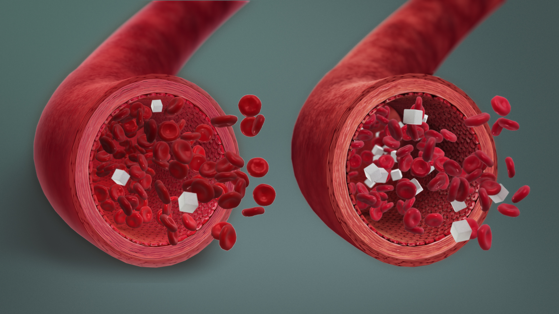 Managing Blood Sugar Fluctuations During Dietary Shifts (image credits: wikimedia)