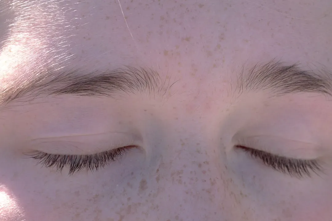 Pale or Yellowish Skin (Image Credits: Unsplash)