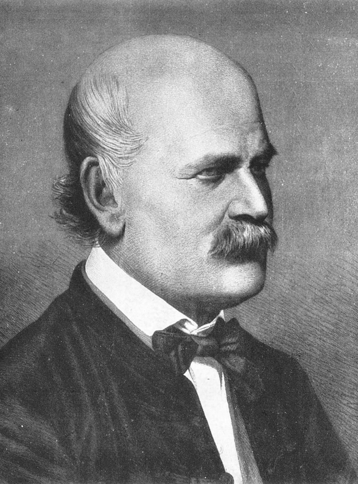 Ignaz Semmelweis - The Doctor Who Discovered Hand Washing (image credits: wikimedia)