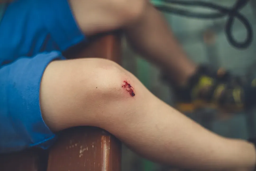 8. Scrapes and Falls That Taught Lessons (Image Credits: Unsplash)