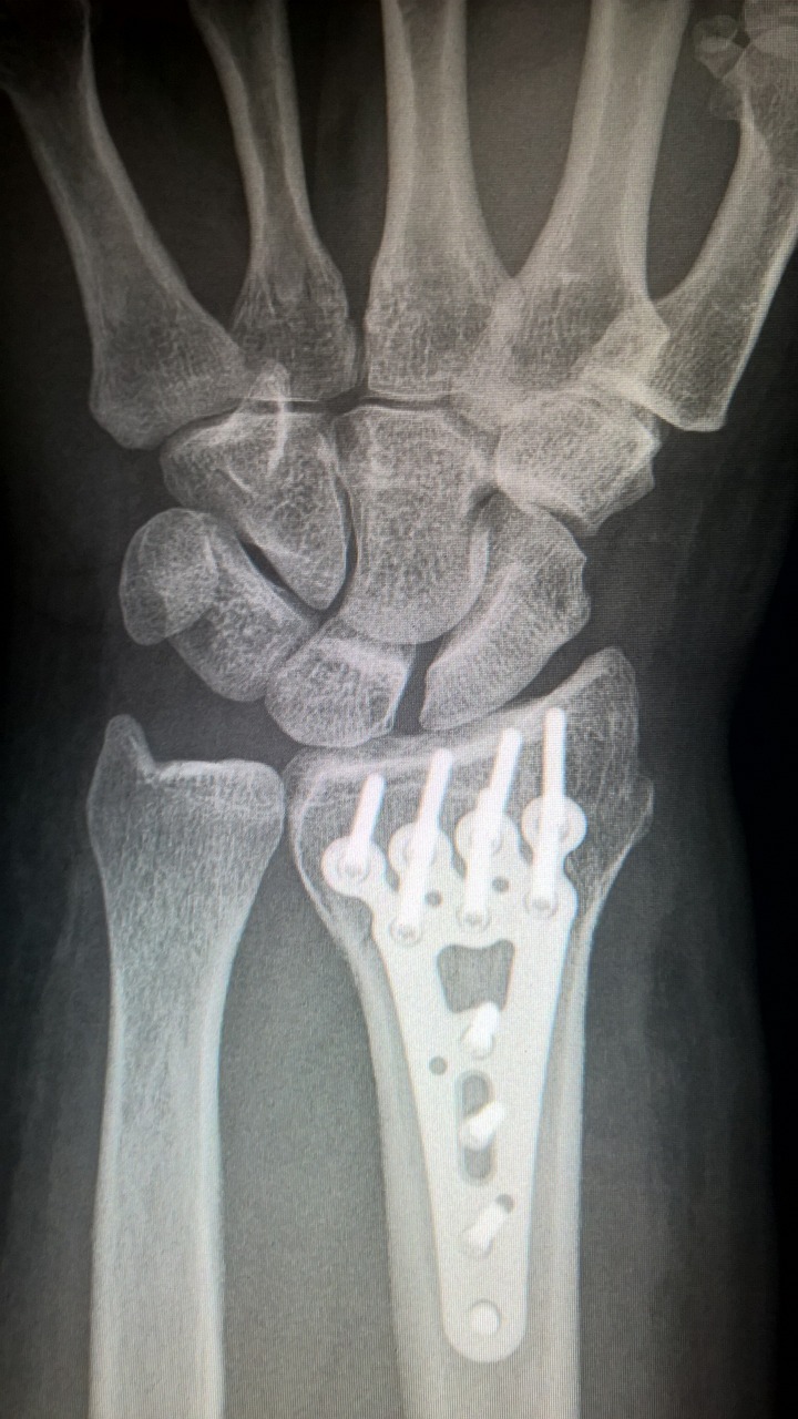 X-rays: A Glowing Discovery (image credits: pixabay)