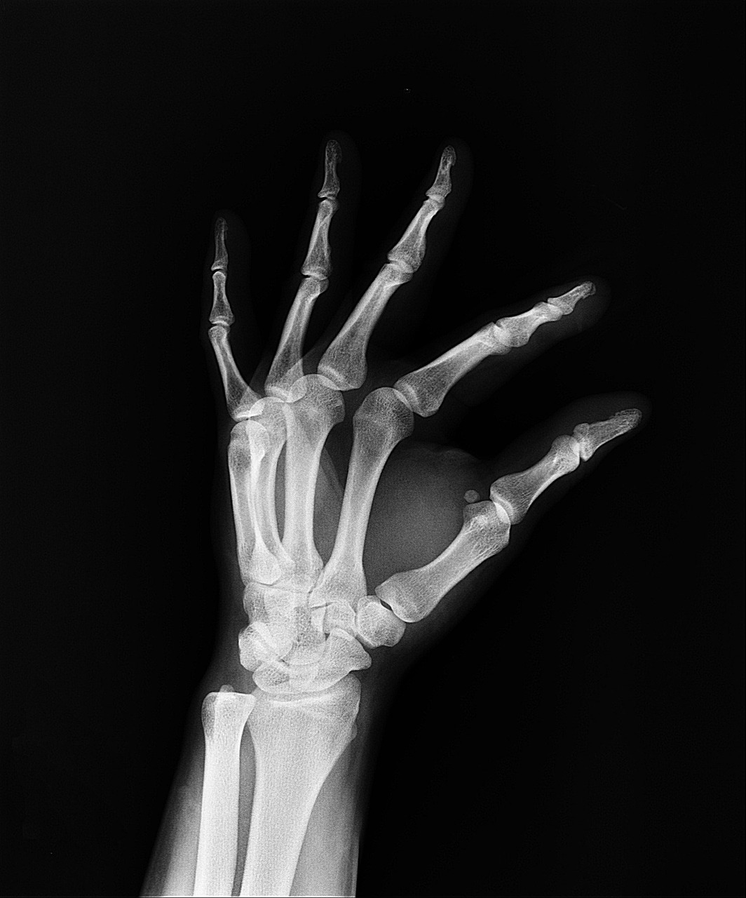 The Discovery of X-Rays (image credits: pixabay)