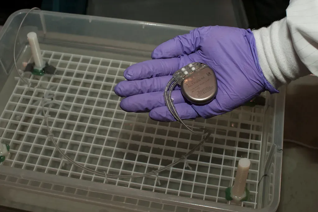 5. The Pacemaker: Born From the Wrong Resistor (Image Credits: Flickr)