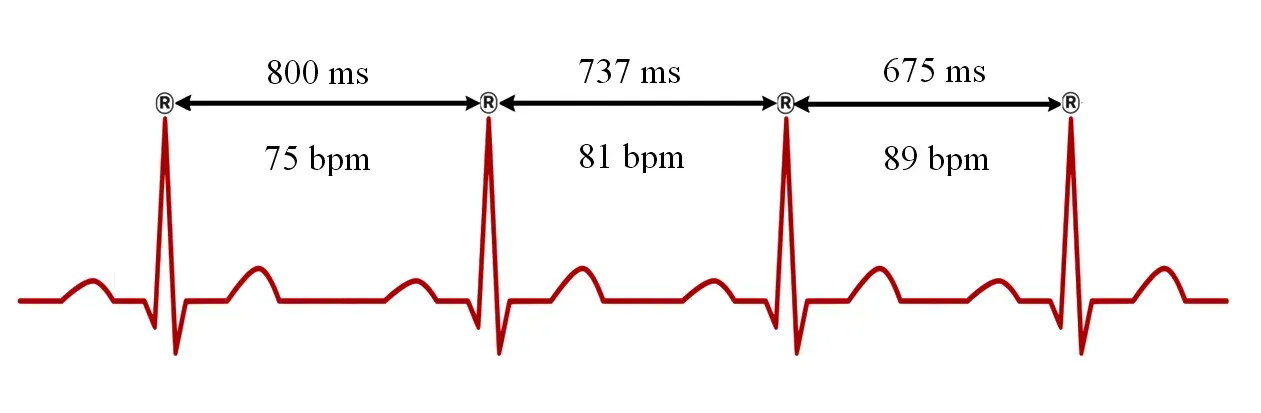 Sylvia Plath's Heartbeat Affirmation (Image Credits: Wikimedia)