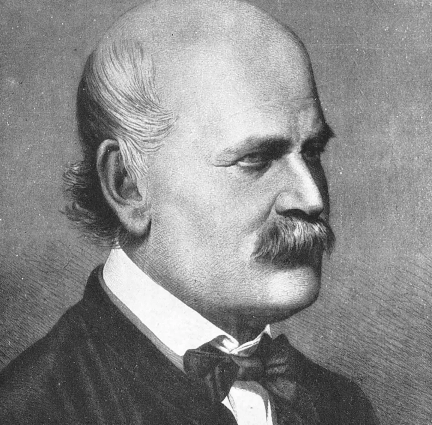 5. Ignaz Semmelweis - The Doctor Who Discovered Handwashing and Was Mocked for It (Image Credits: Wikimedia)