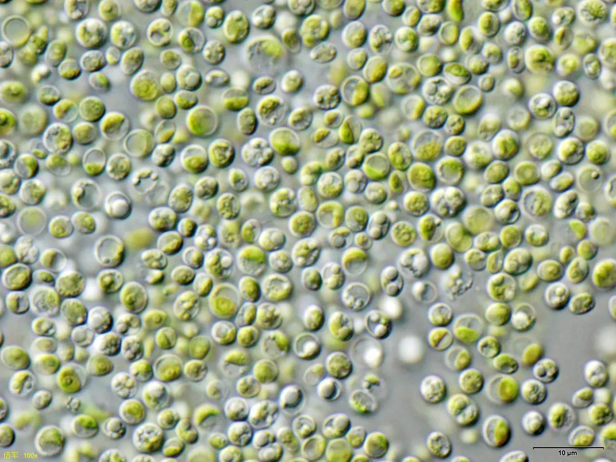 Chlorella: The Green Detoxifier Taking Center Stage (Image Credits: Wikimedia)
