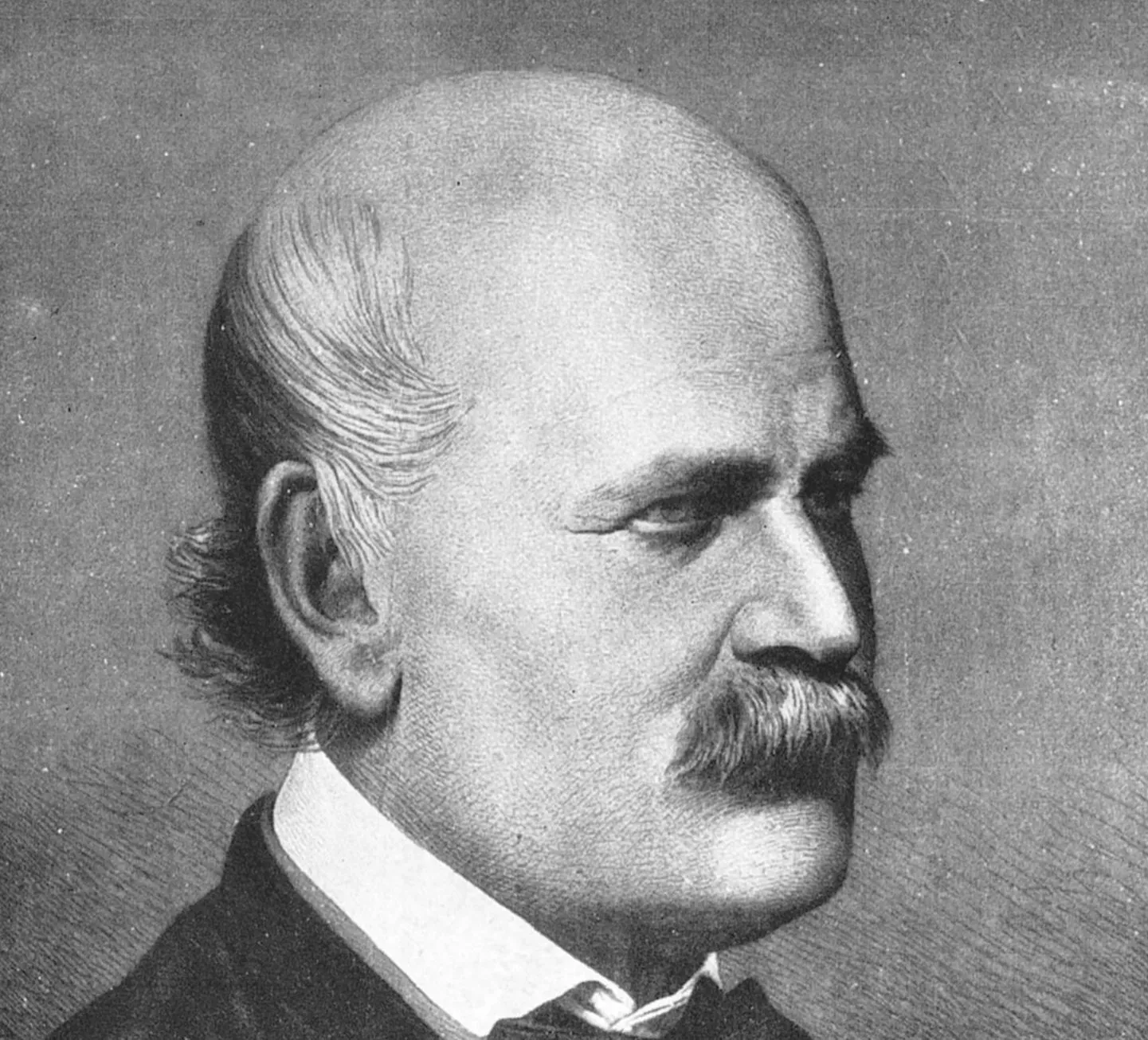 5. Ignaz Semmelweis - The Doctor Who Discovered Hand Washing (and Was Ignored) (Image Credits: Wikimedia)