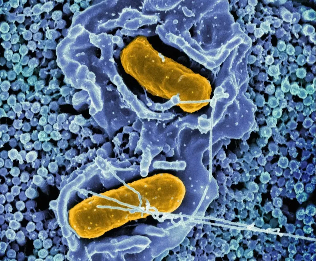 Germ Theory of Disease (Image Credits: Unsplash)