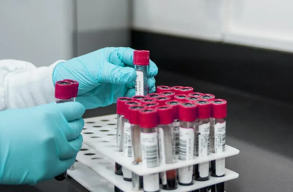 A Blood Test Can Detect Alzheimer's With Shocking Accuracy (Image Credits: Pixabay)