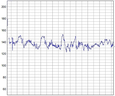 Increased Heart Rate and Palpitations (image credits: wikimedia)