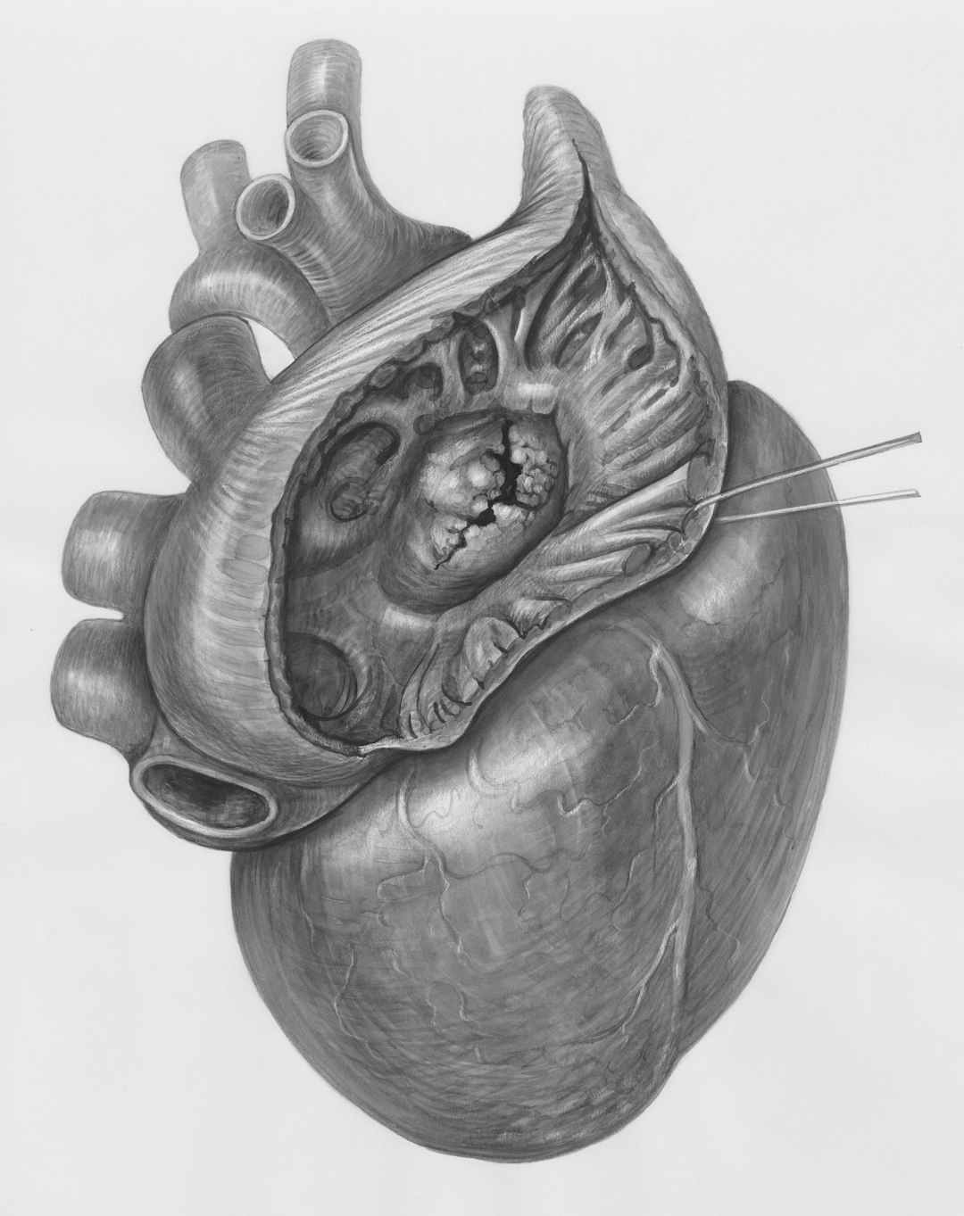 Pacemaker: An Unexpected Heartbeat (image credits: unsplash)