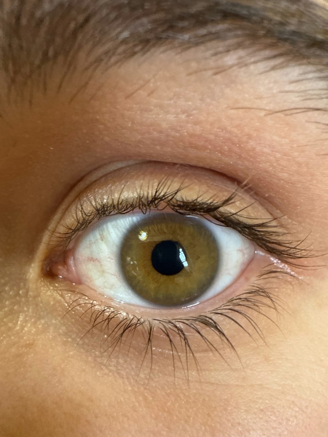 Pain Sensitivity and Eye Pigmentation (image credits: unsplash)