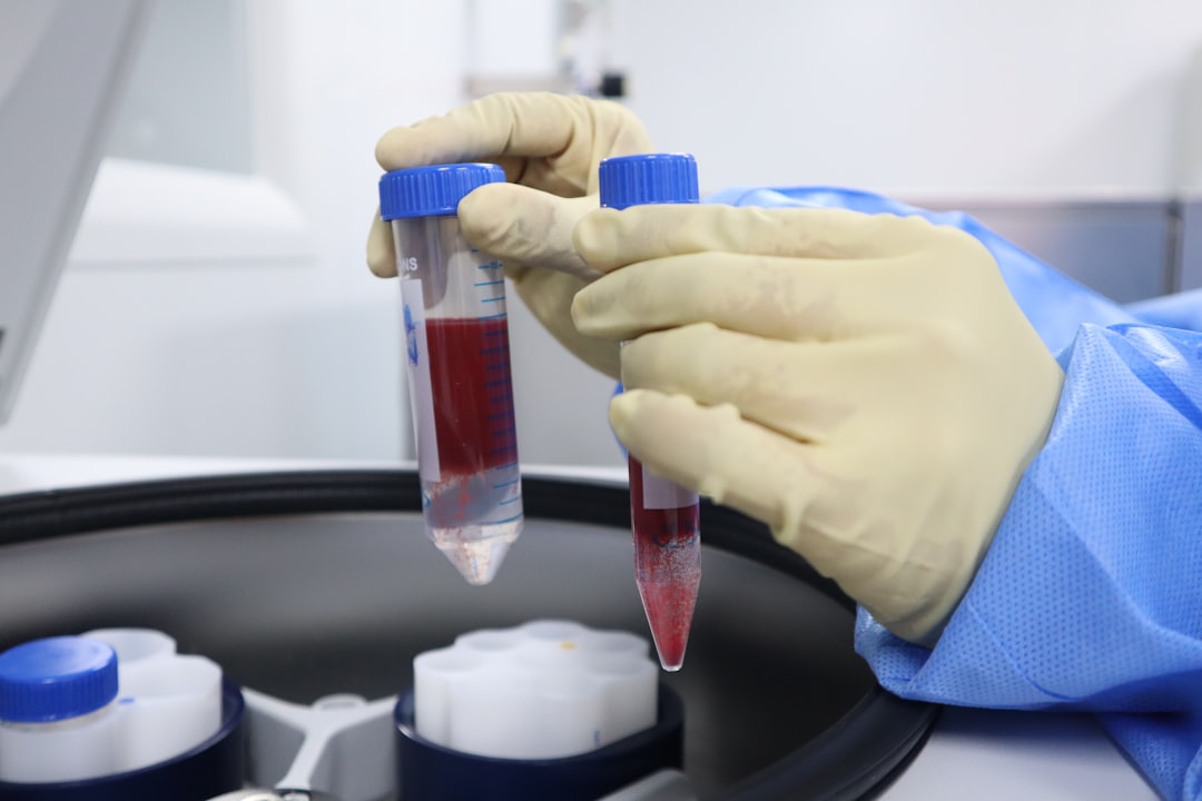 A Blood Test That Detects Alzheimer's Disease (image credits: unsplash)