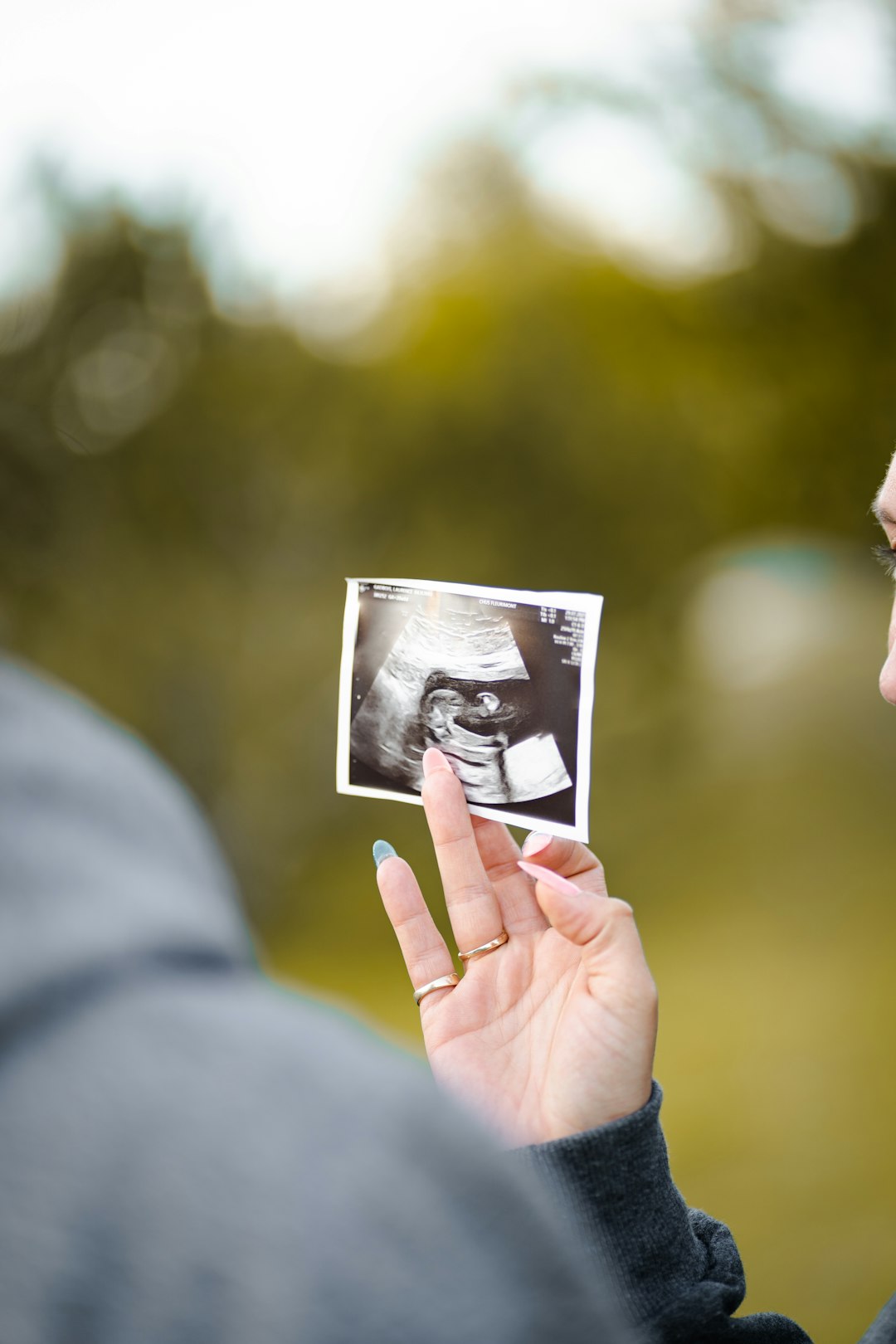 AI Ultrasounds and Personalized Reports (image credits: unsplash)