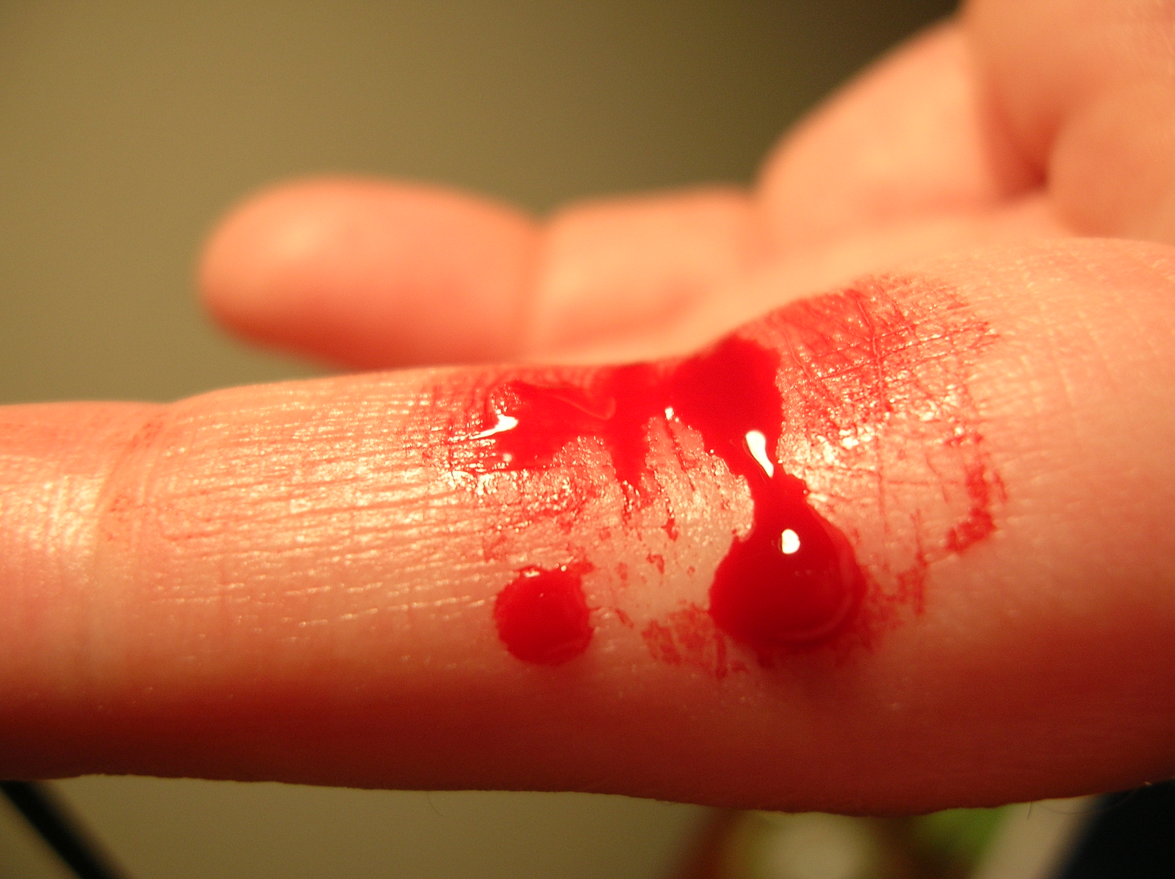 Postpartum Bleeding Can Last Weeks (image credits: wikimedia)