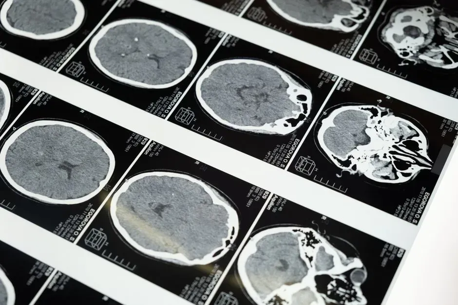 The teenage brain is rewiring who it listens to (Image Credits: Pexels)