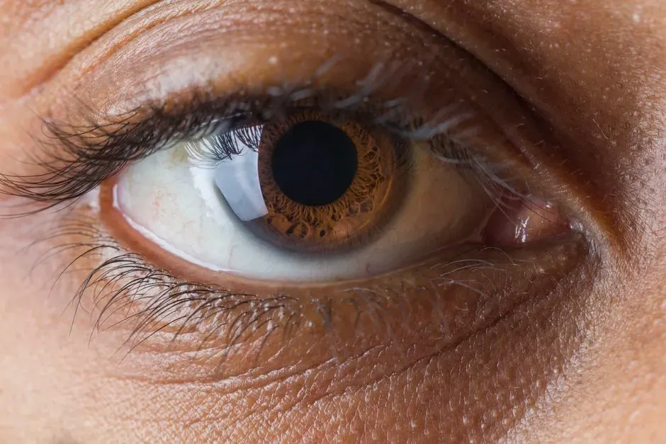 1. Eyelid Twitches and Unexplained Muscle Spasms (Image Credits: Pexels)