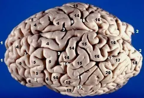 11. Left-Brained vs. Right-Brained People (By John A Beal, PhD
Dep't. of Cellular Biology & Anatomy, Louisiana State University Health Sciences Center Shreveport, CC BY 2.5)