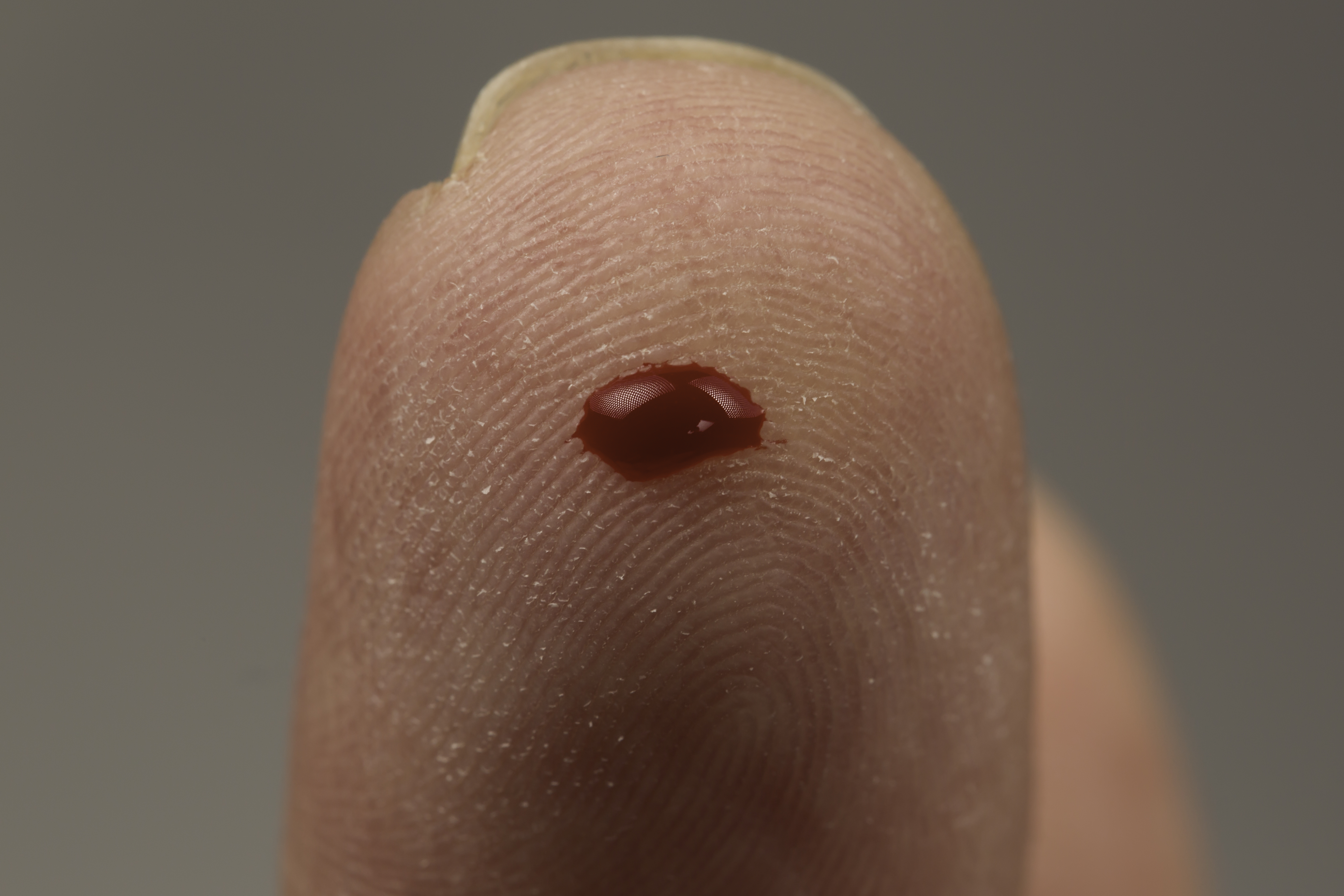 Hemophobia: When Blood Becomes the Enemy (image credits: Blood Test, CC BY 2.0, https://commons.wikimedia.org/w/index.php?curid=40685781)