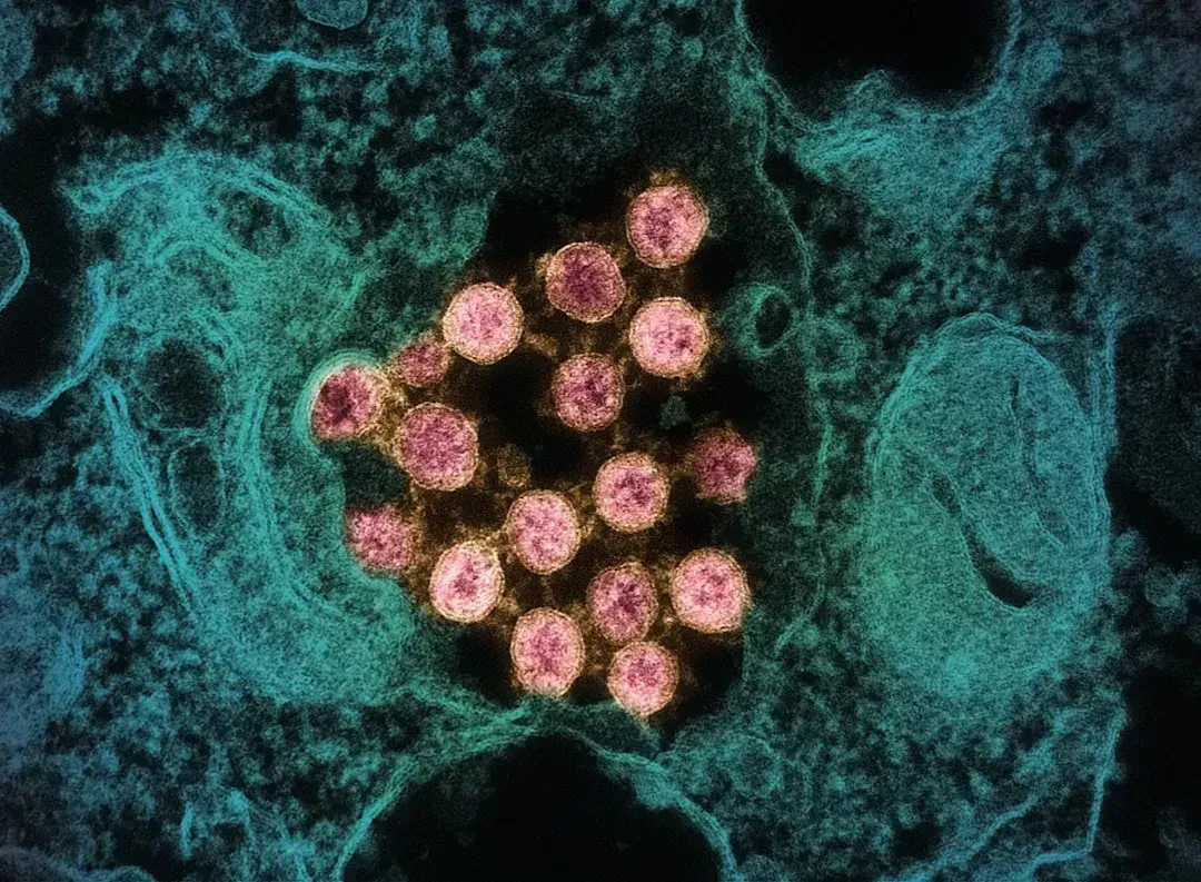 7. Ancient Viruses Frozen in Permafrost Can Wake Up (Image Credits: Unsplash)