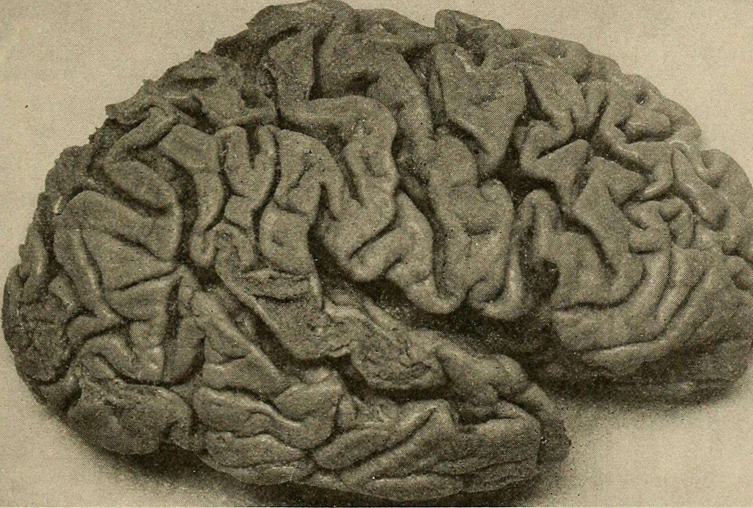 The Brain's Response: Understanding the Neurological Component (image credits: wikimedia)