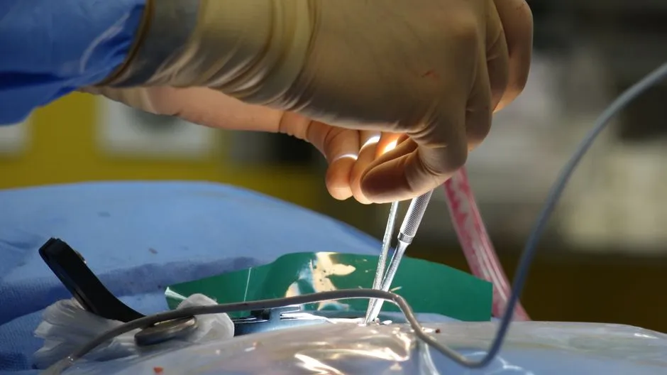 Numbness in the Groin or Inner Thighs (Saddle Anesthesia) (Image Credits: Pexels)
