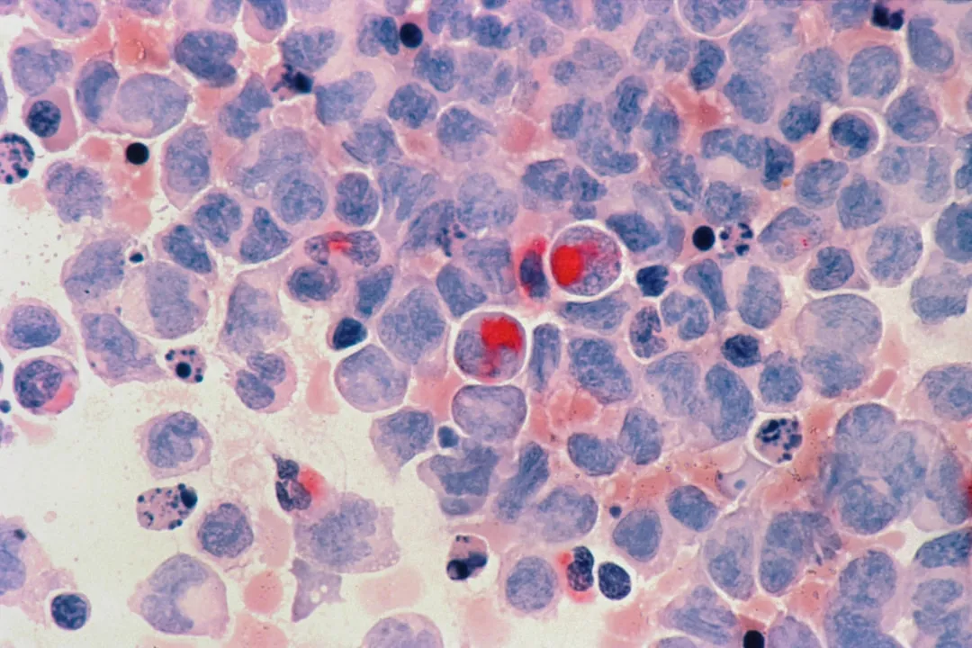 Human Health: Cancer, Neurological Harm, and Endocrine Disruption (Image Credits: Unsplash)
