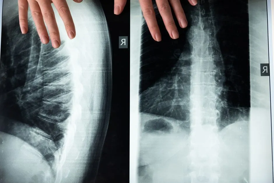 Back Pain with Fever or Chills (Image Credits: Pexels)