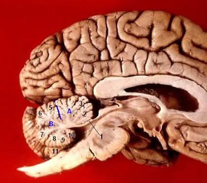 The Cerebellum Is the Key Player (By John A Beal, PhD
Dep't. of Cellular Biology & Anatomy, Louisiana State University Health Sciences Center Shreveport, CC BY 2.5)