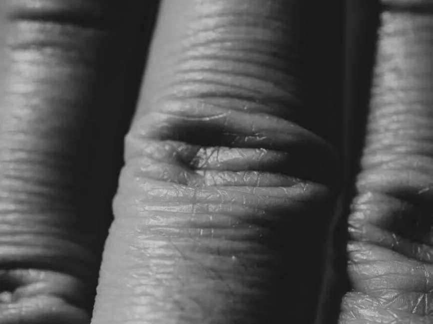 What Abnormal Wrinkling Can Reveal About Your Health (Image Credits: Pexels)
