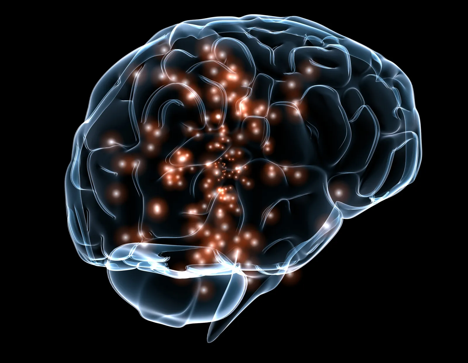 Your Brain Processes Familiar Music Differently (By courtesy of Massachusetts General Hospital and Draper Labs, Public domain)