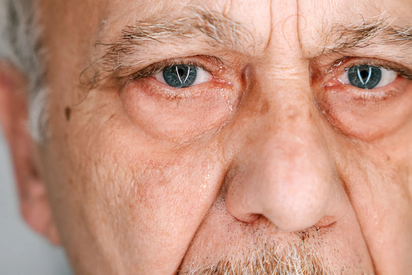 Glare: The Underappreciated Hazard (Image Credits: Pexels)