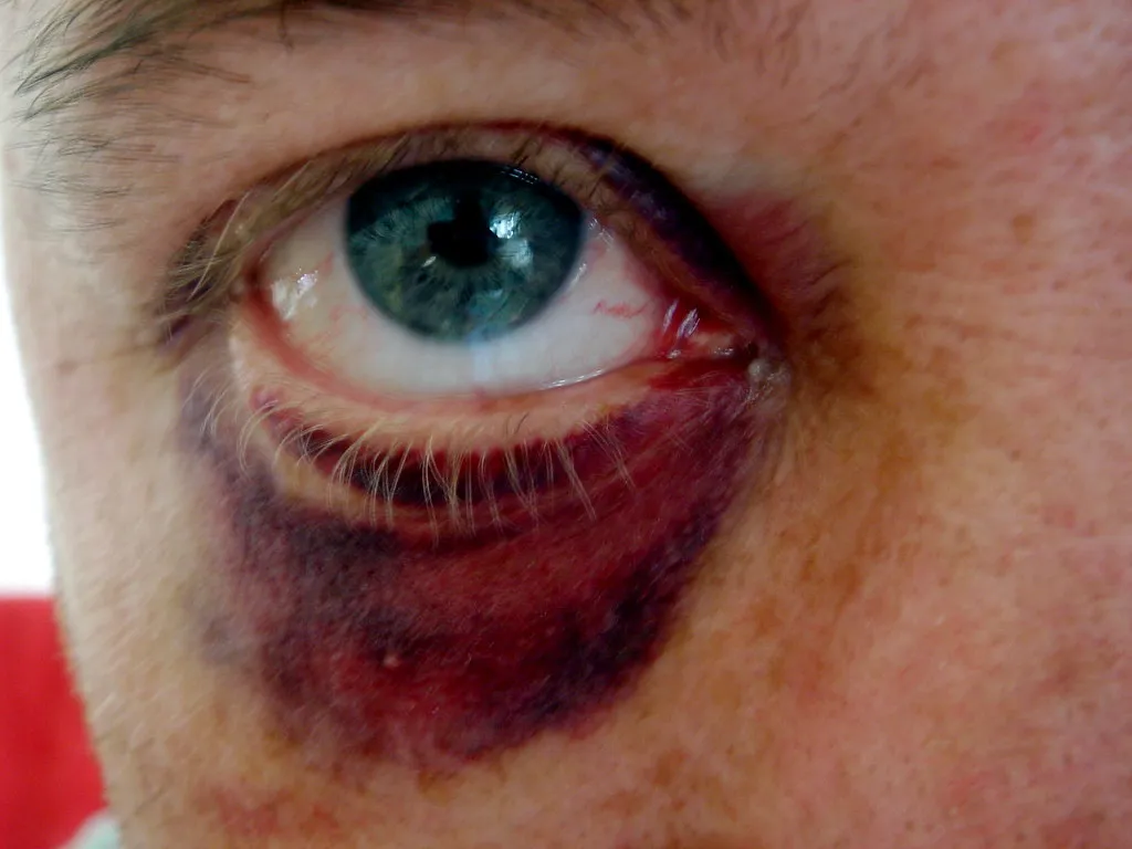 The BMJ Issued a Formal Warning (diongillard, Flickr, CC BY 2.0)