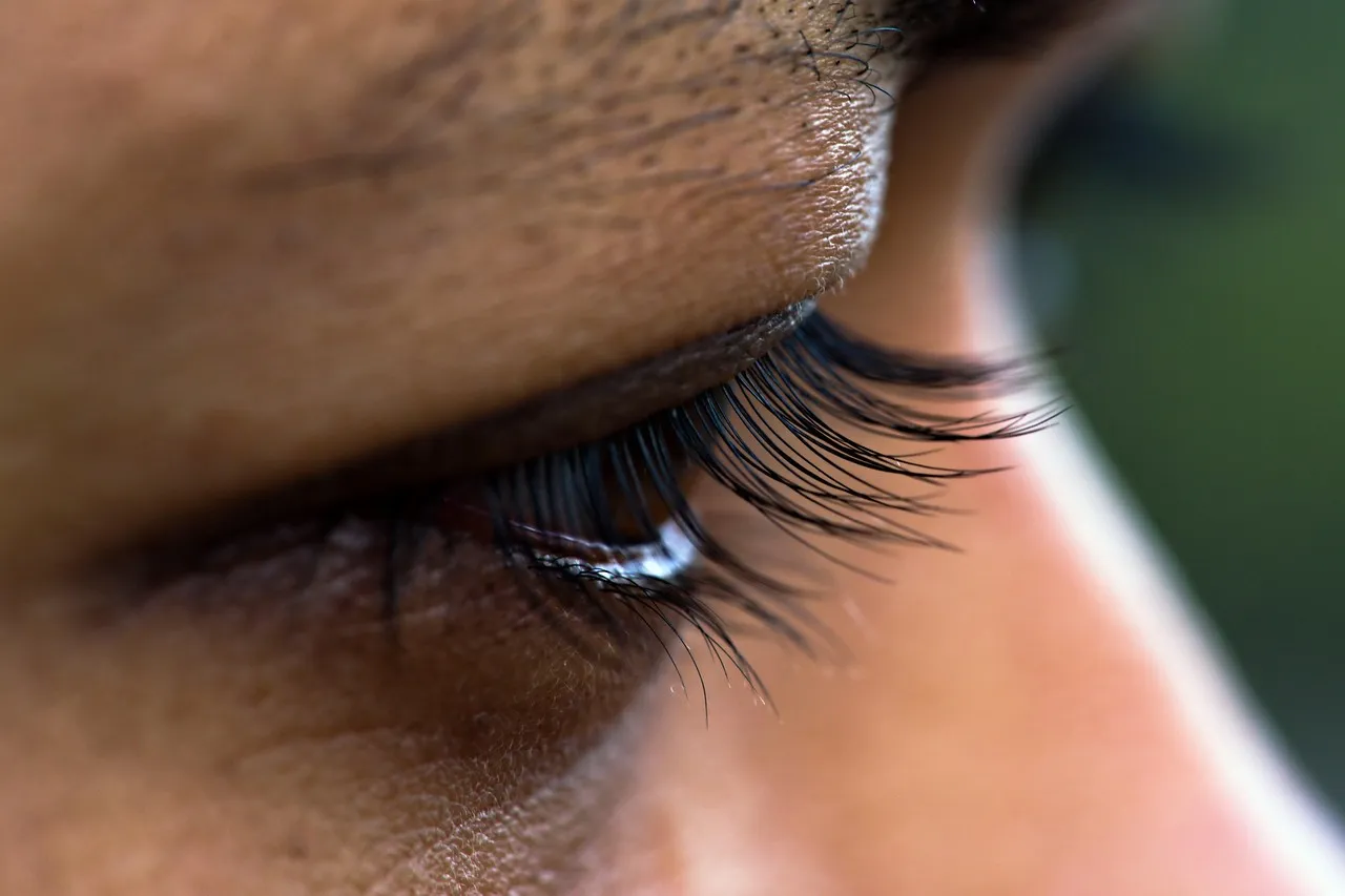 When Neurological Conditions Are Involved (Image Credits: Pixabay)