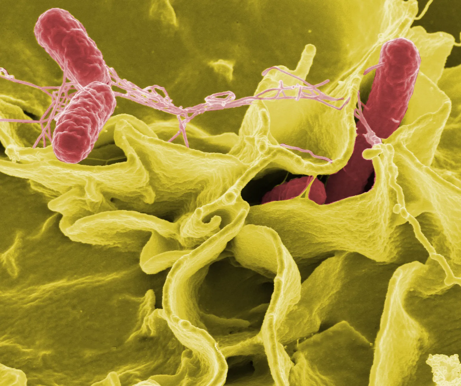 The Most Common Reasons Food Gets Recalled (NIAID: These high-resolution (300 dpi) images may be downloaded directly from this site., Public domain)