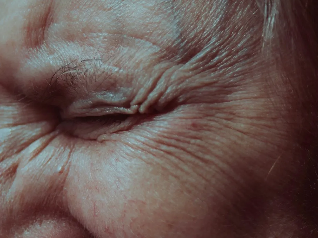 What Actually Happens Inside the Nose as You Age (Image Credits: Unsplash)