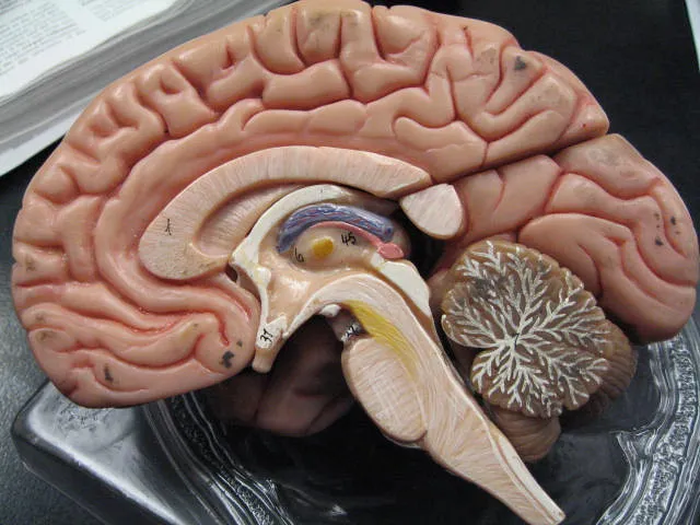 The Brainstem Misfire Theory (GreenFlames09, Flickr, CC BY 2.0)