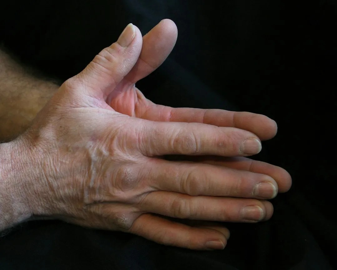 Raynaud's Phenomenon: When the Body Overreacts (Image Credits: Unsplash)