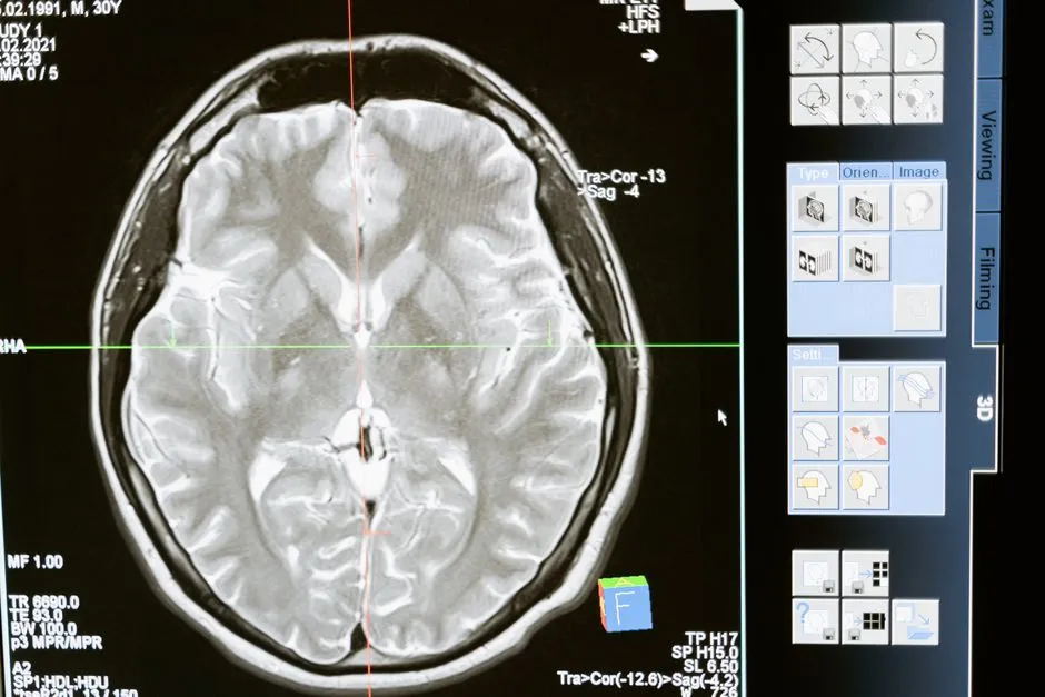 How Your Brain Organizes Experience Into Episodes (Image Credits: Pexels)