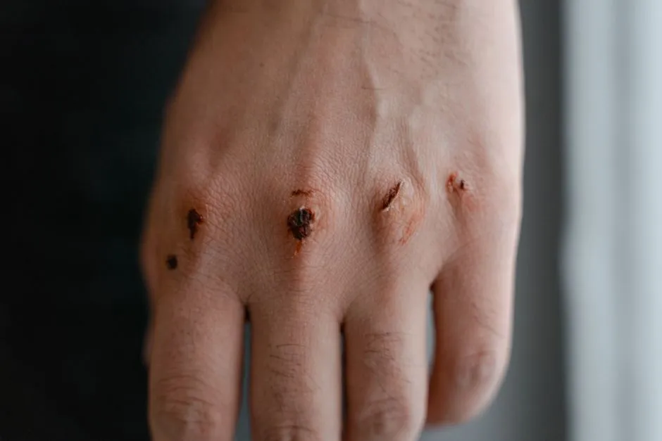 Even Small Wounds from Garden Tools Are a Real Concern (Image Credits: Pexels)