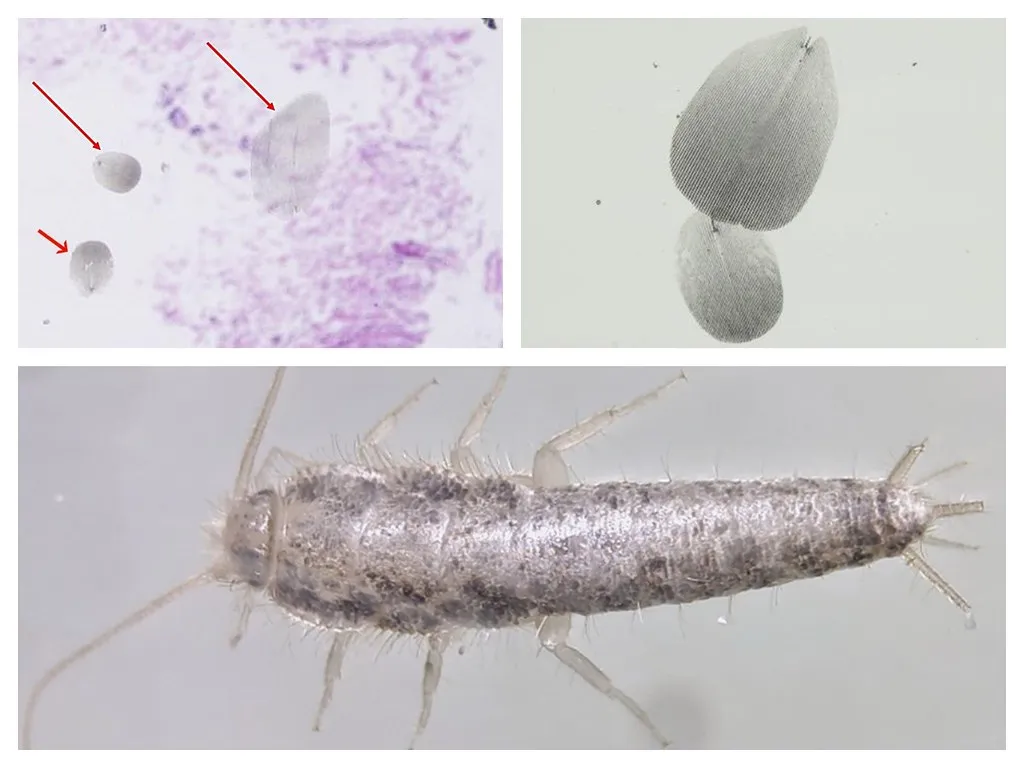 How Reproduction Accelerates Under Humid Conditions (Y Rosen, MD & P Meseguer, MD, Flickr, CC BY-SA 2.0)