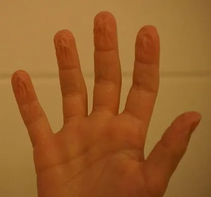 Your Wrinkle Pattern Is Uniquely Yours, Every Single Time (By Sebastian Wallroth, CC BY 3.0)