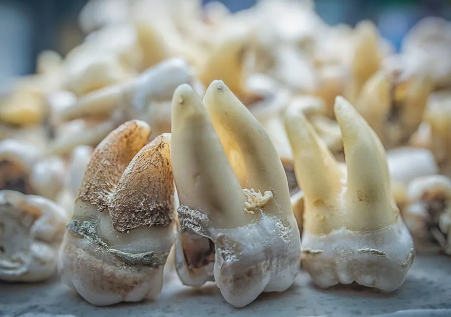 Frequency Is the Real Problem With Crackers (Image Credits: Pexels)