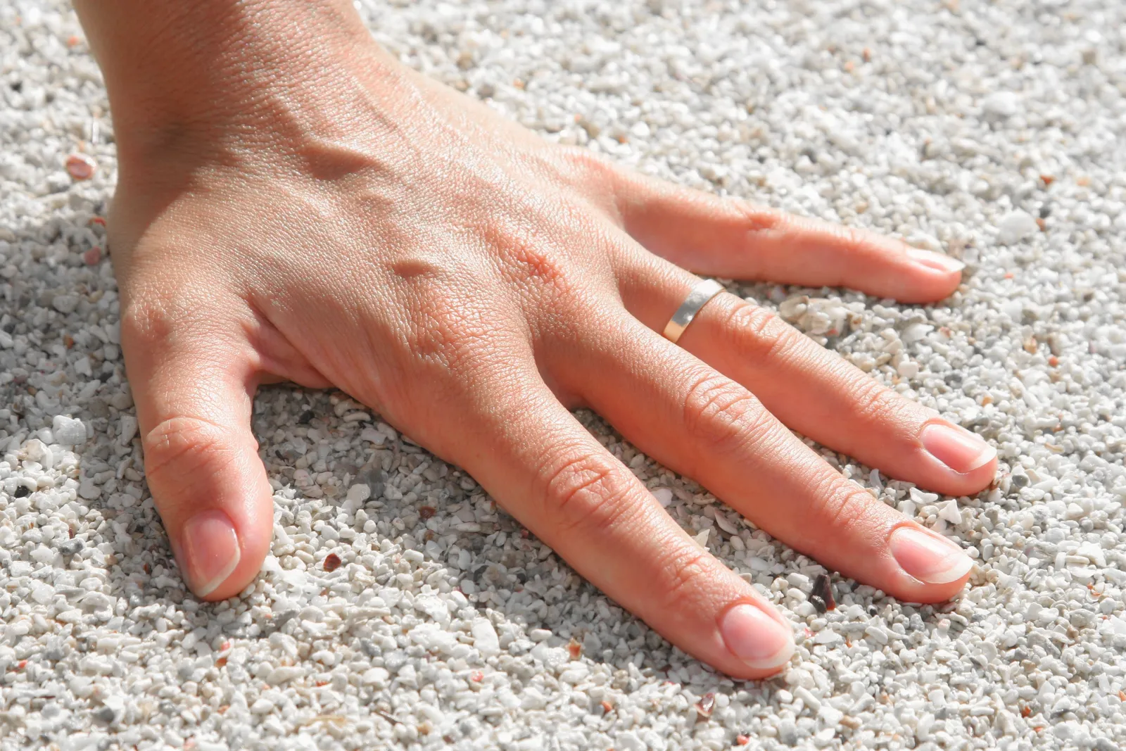 Raynaud's Phenomenon: When the Body Overreacts (Image Credits: Pexels)