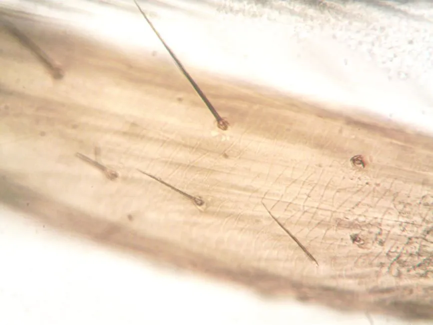 The Inner Ear Mechanism Behind It (Image Credits: Pexels)