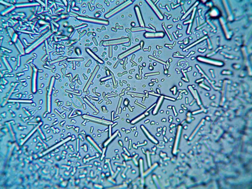 Clostridium Perfringens: The Bug That Loves a Holiday Kitchen (Image Credits: Pexels)