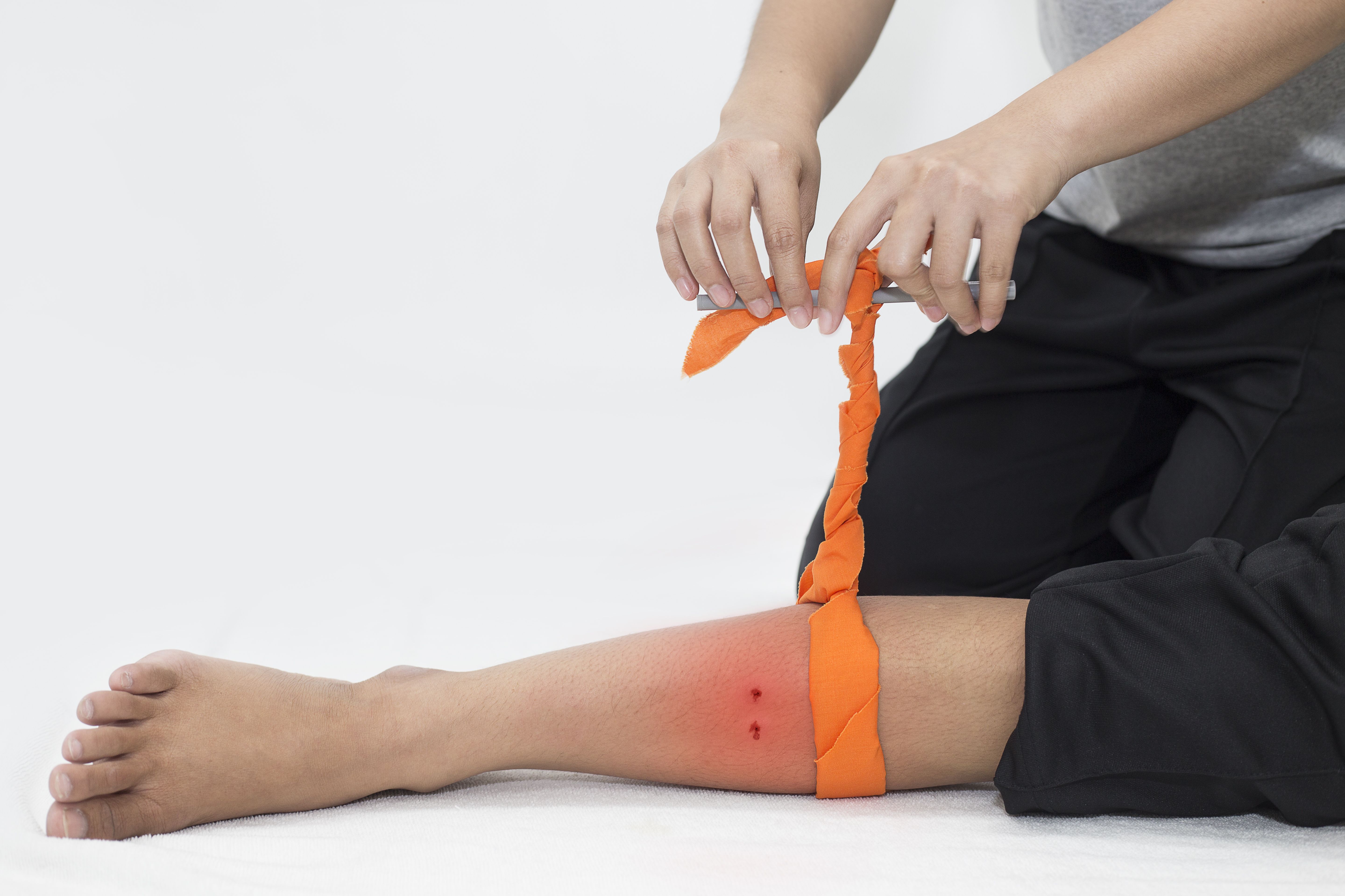 Step 5: Prepare for Emergency Response (Image Credits: Shutterstock)